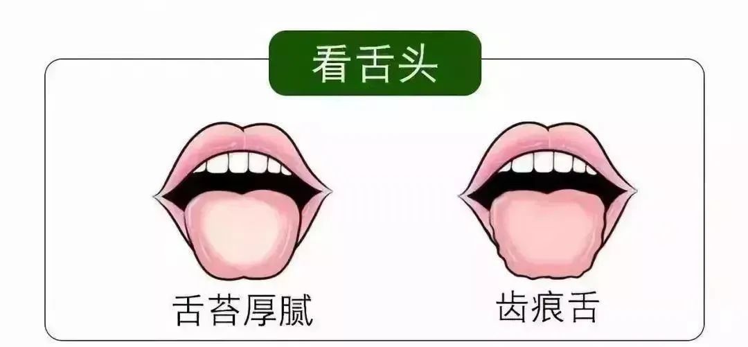 清明時(shí)節(jié)雨紛紛 疏通經(jīng)絡(luò)馬上給身體加分！